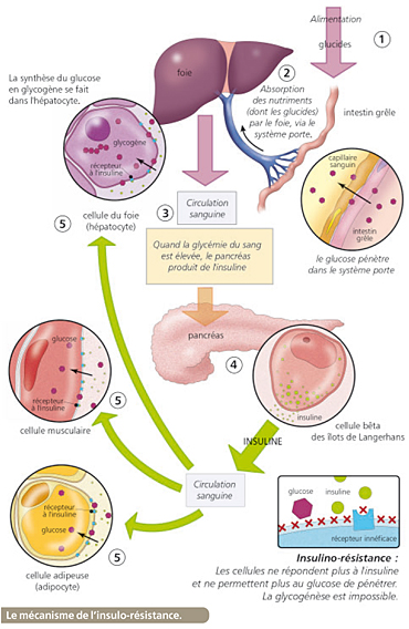 diabete