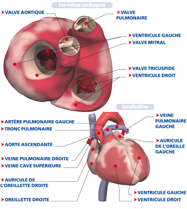 Illustration Anatomique De La Sténose De La Valve Pulmonaire